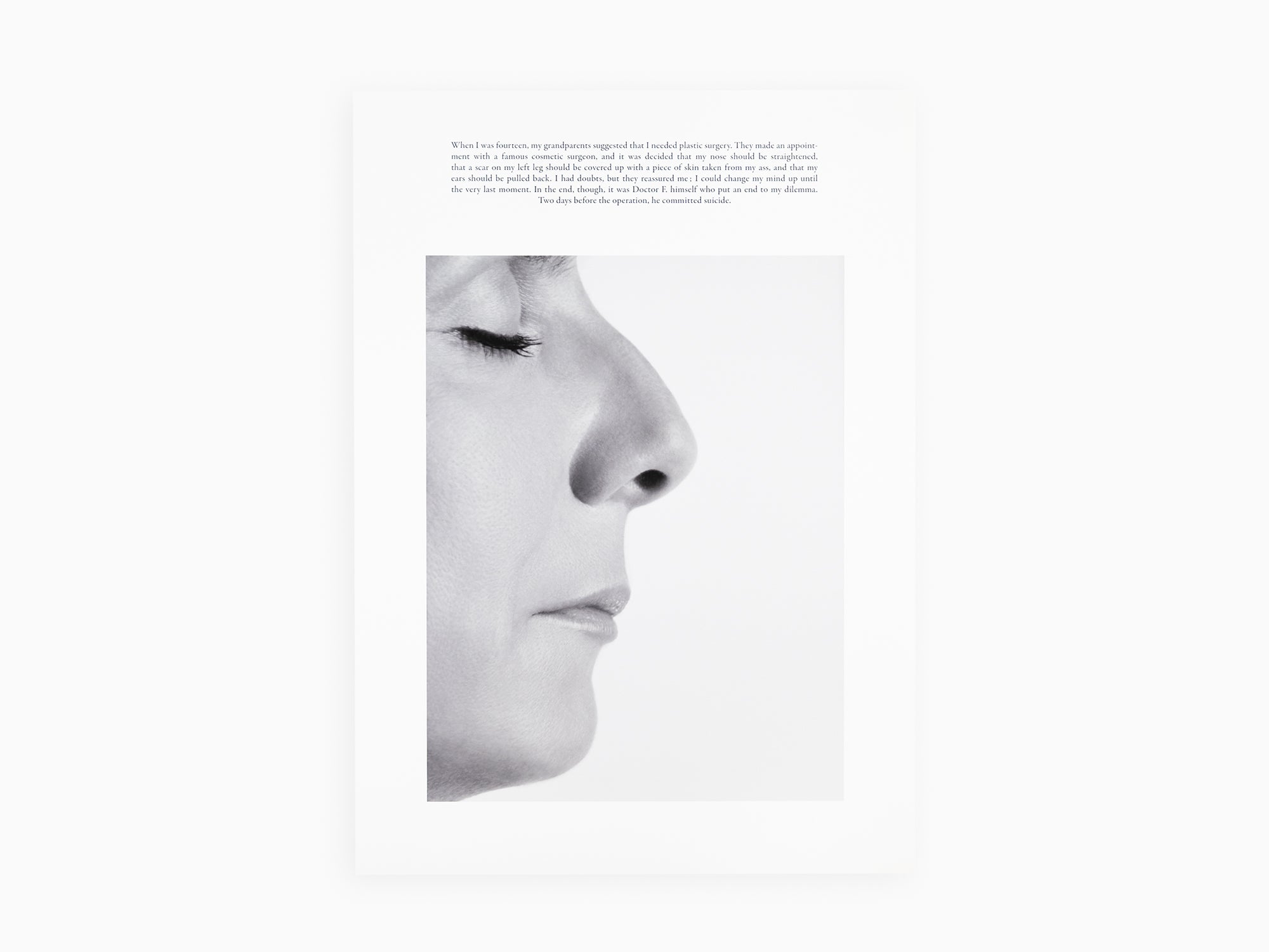 Sophie Calle - "La chirurgie esthétique"