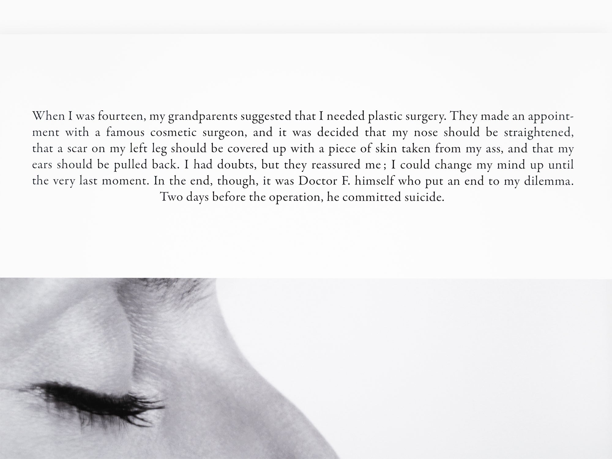 Sophie Calle - "La chirurgie esthétique"