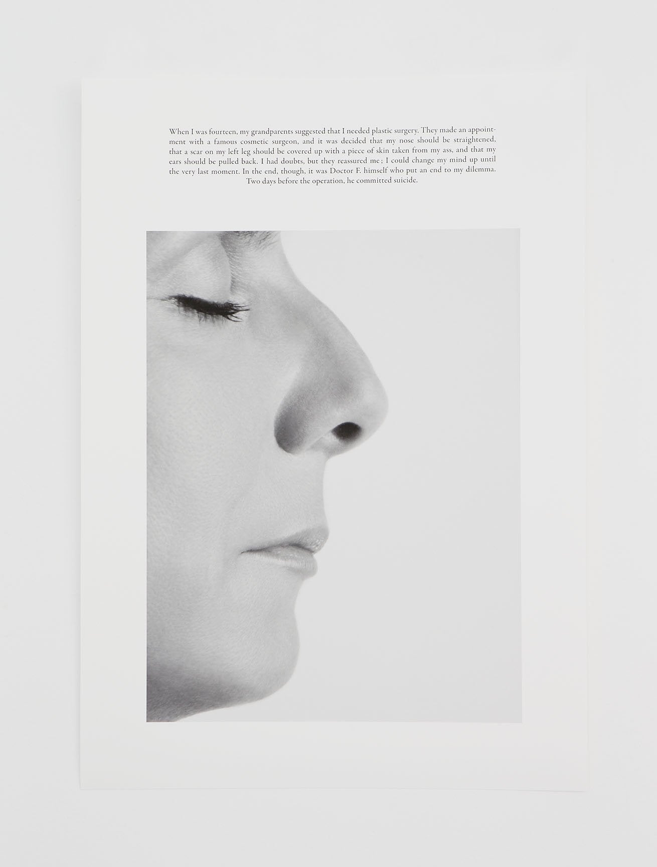 Sophie Calle - "The plastic surgery"